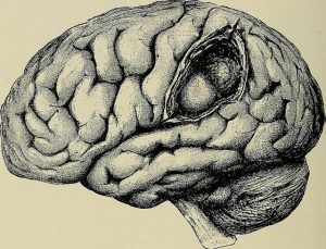 image brain